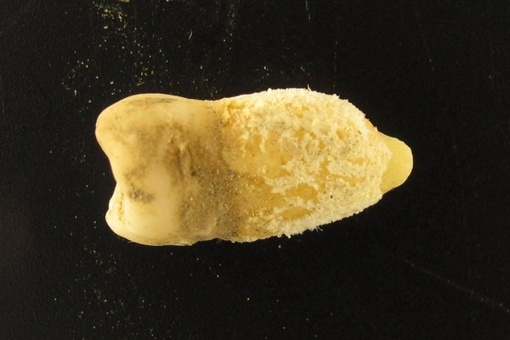 Колумб ни в чем ни виноват: зуб боливийской мумии переписал историю скарлатины