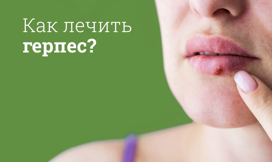 Герпес: Причины, симптомы, лечение